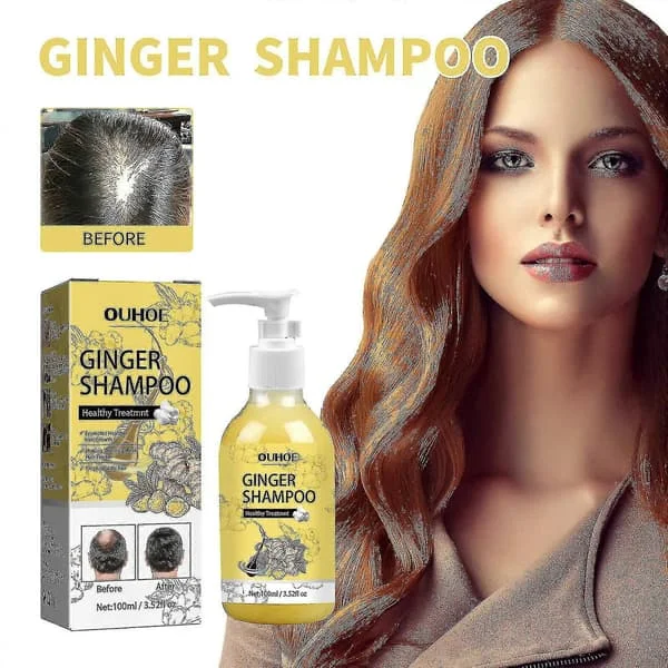 OUHOE Ingefær Shampoo til Tykt Hår Fugtgivende Anti-Kløe Opstrammende Shampoo til Tykt Hår Fluffy Balsam Shampoo | |-3750782914398