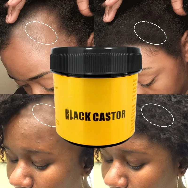 AliExpress - GZE JAMAICAN Black Castor Oil Pure Cold-Pressed für Haarwachstum, Hautfeuchtigkeit und Kopfhautgesundheit – Förderung von dickem Haar