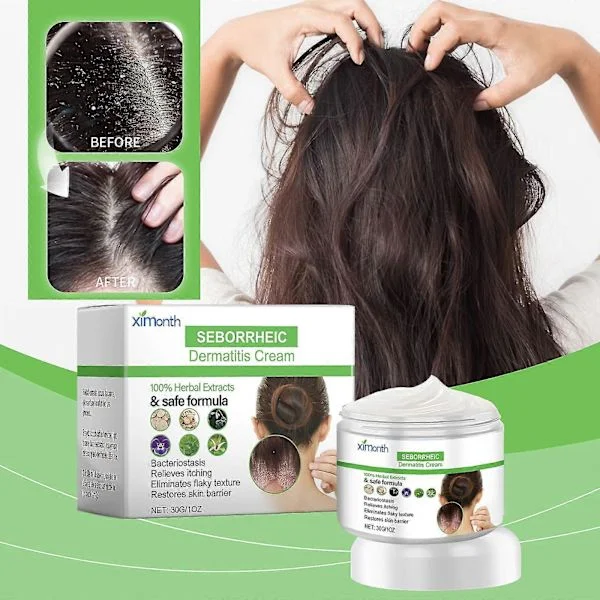 Seboroisk dermatitiscreme, hurtigtvirkende hovedbundsbehandling til tør og kløende hovedbund, kløestillende mod skæl (2 stk)