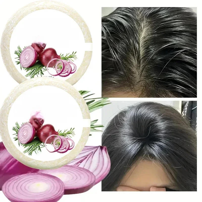 AliExpress - Zwiebel- und Biotin-Shampoo-Seife – 60 g, geeignet für alle Haartypen, feuchtigkeitsspendend und glättend, reich an Rosmarinextrakt