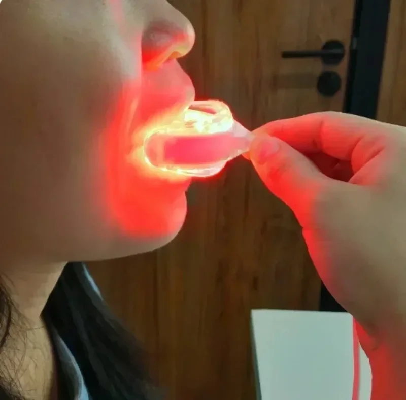 AliExpress - Starlite Fleece-Traitement de la maladie des gencives, pariodmédailles, soins bucco-dentaires, thérapie par la lumière rouge, promeut la 